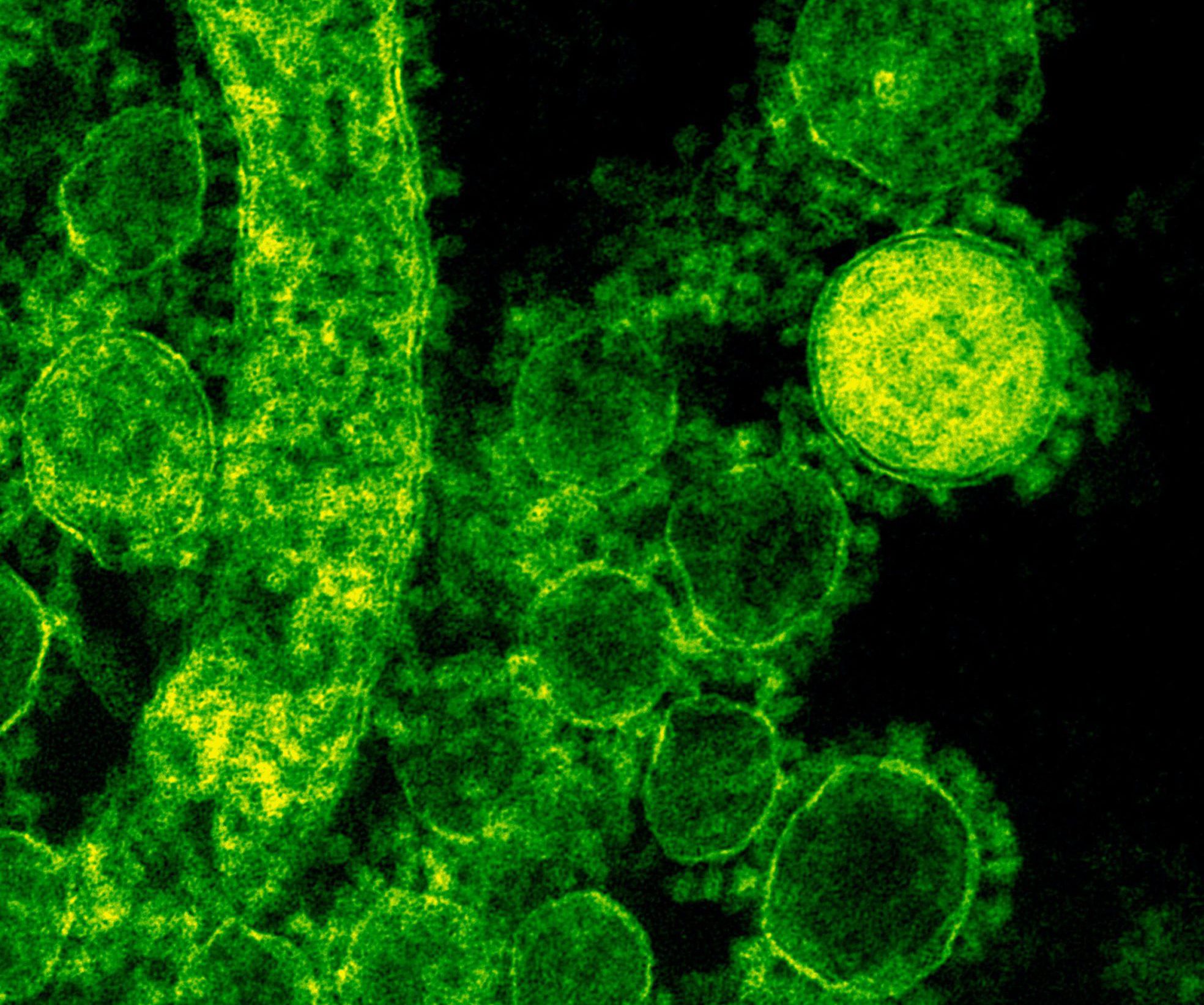 HPV
