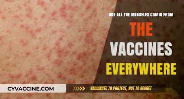 Measles Myth: Vaccines and the Source of Outbreaks