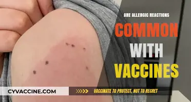 Are Vaccine Allergic Reactions Common? Understanding Risks and Safety