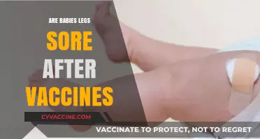 Do Vaccines Cause Leg Soreness in Babies? Expert Insights Revealed