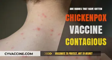 Chickenpox Vaccine: Can Babies Still Spread the Virus?