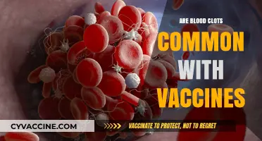 Are Blood Clots a Common Side Effect of Vaccines?