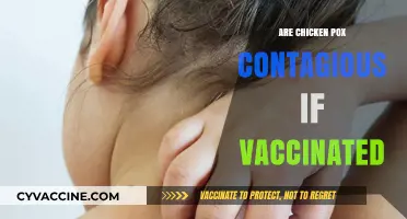 Vaccinated Against Chickenpox: Can You Still Spread It?