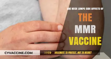 Neck Lumps: MMR Vaccine Side Effect?