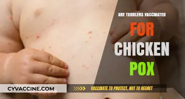 Should Toddlers Get the Chicken Pox Vaccine? Expert Insights
