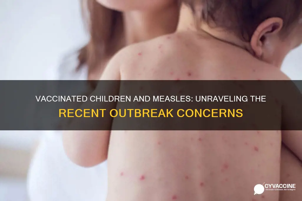 are vaccinated children contracting the messels
