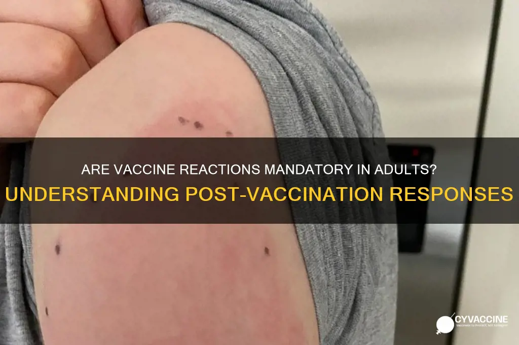 are vaccine reactions mandatory in adults