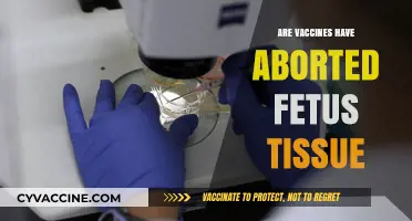 Vaccines and Fetal Tissue: Separating Fact from Fiction
