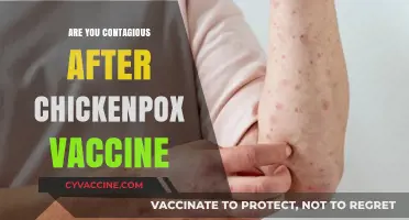 Can You Spread Chickenpox After Getting Vaccinated? What to Know