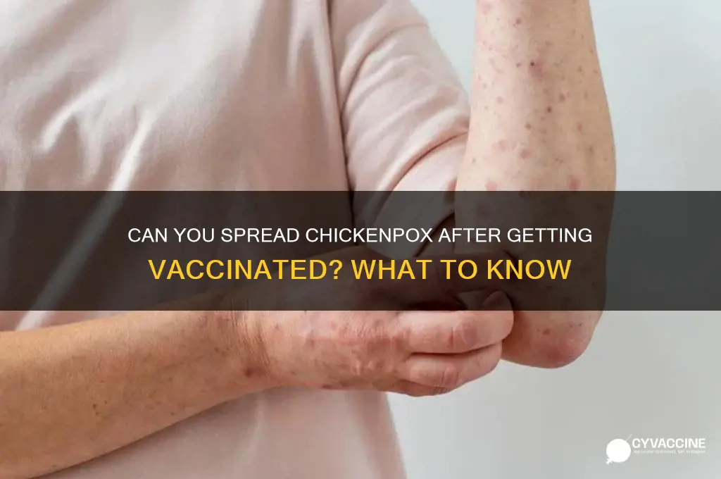 are you contagious after chickenpox vaccine