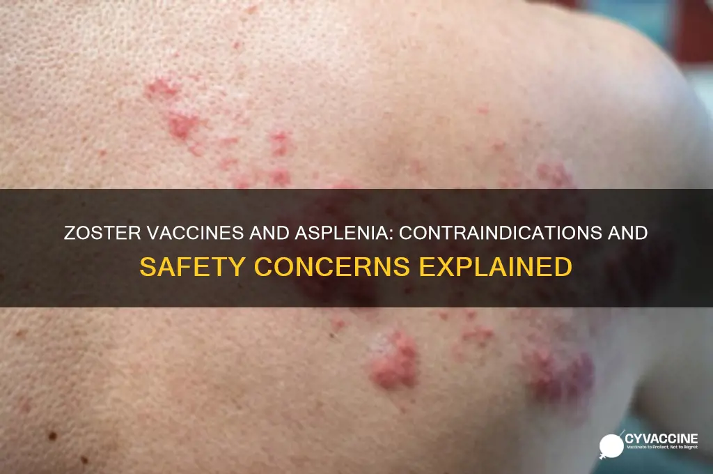 are zoster vaccines contraindicated in asplenia