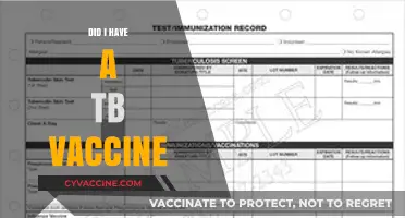 Did I Have a TB Vaccine? Unraveling Your Immunization History