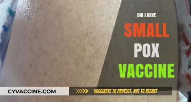 Did I Have the Smallpox Vaccine? Unraveling My Immunization History