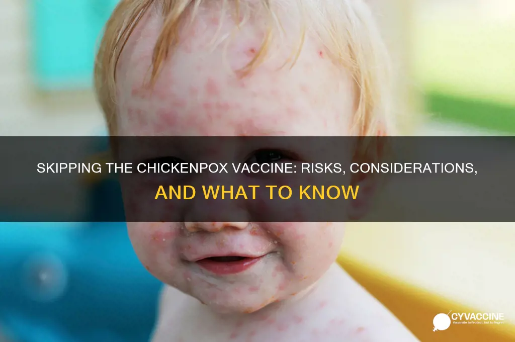 did not had the chickenpox vaccine