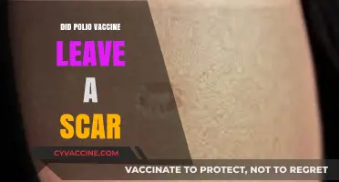Polio Vaccine Scars: Uncovering the Truth Behind the Mark