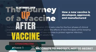 Do Antibodies Appear After Vaccination? Understanding Post-Vaccine Immunity