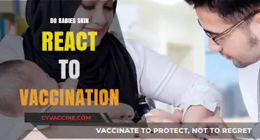 Vaccination and Baby Skin: Understanding Reactions and What's Normal
