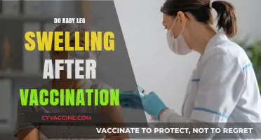 Baby Leg Swelling After Vaccination: Causes, Concerns, and Care Tips