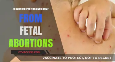 Chickenpox Vaccine: Fetal Cells, Not Abortions