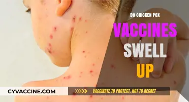 Chicken Pox Vaccine Side Effects: Swelling Concerns Explained