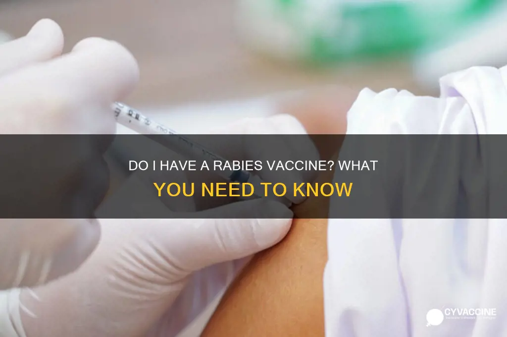 do i have a rabies vaccine