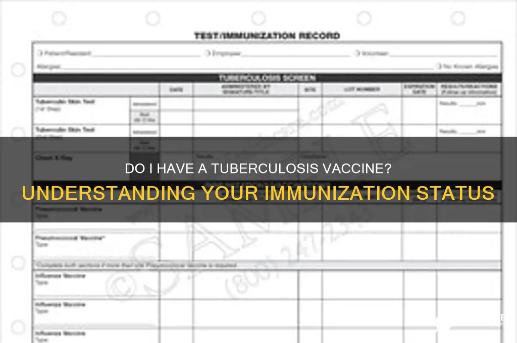 do i have a tuberculosis vaccine
