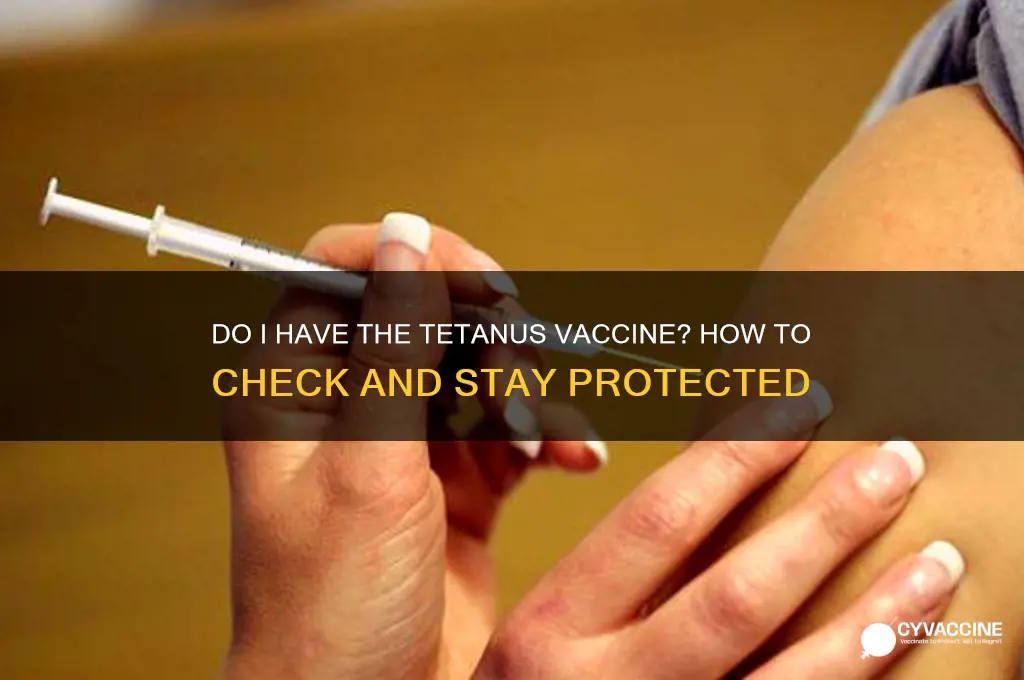 do i have the tetanus vaccine