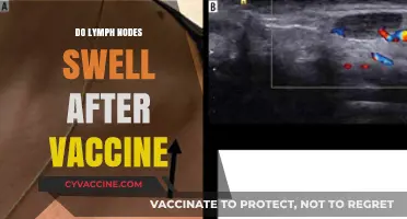 Vaccine Side Effects: Understanding Swollen Lymph Nodes Post-Immunization