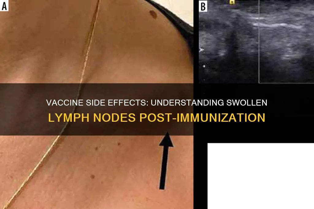 do lymph nodes swell after vaccine