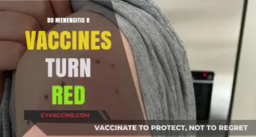 Do Meningitis B Vaccines Cause Redness? Facts and Insights