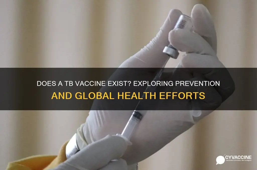 do they have a tb vaccine