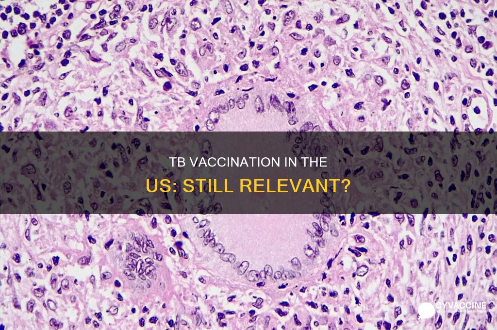 do they still vaccinate for tb in the us