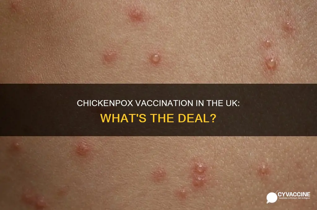 do they vaccinate for chickenpox in the uk