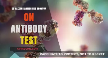 Vaccine Antibodies: Will They Show on an Antibody Test?