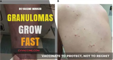 Understanding Vaccine-Induced Granulomas: Growth Rate and What to Expect
