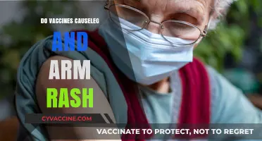 Do Vaccines Cause Leg and Arm Rashes? Facts and Insights