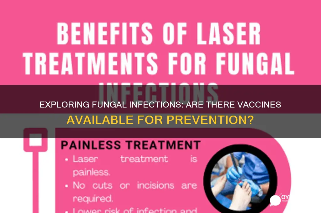 do vaccines exist for fungal infections