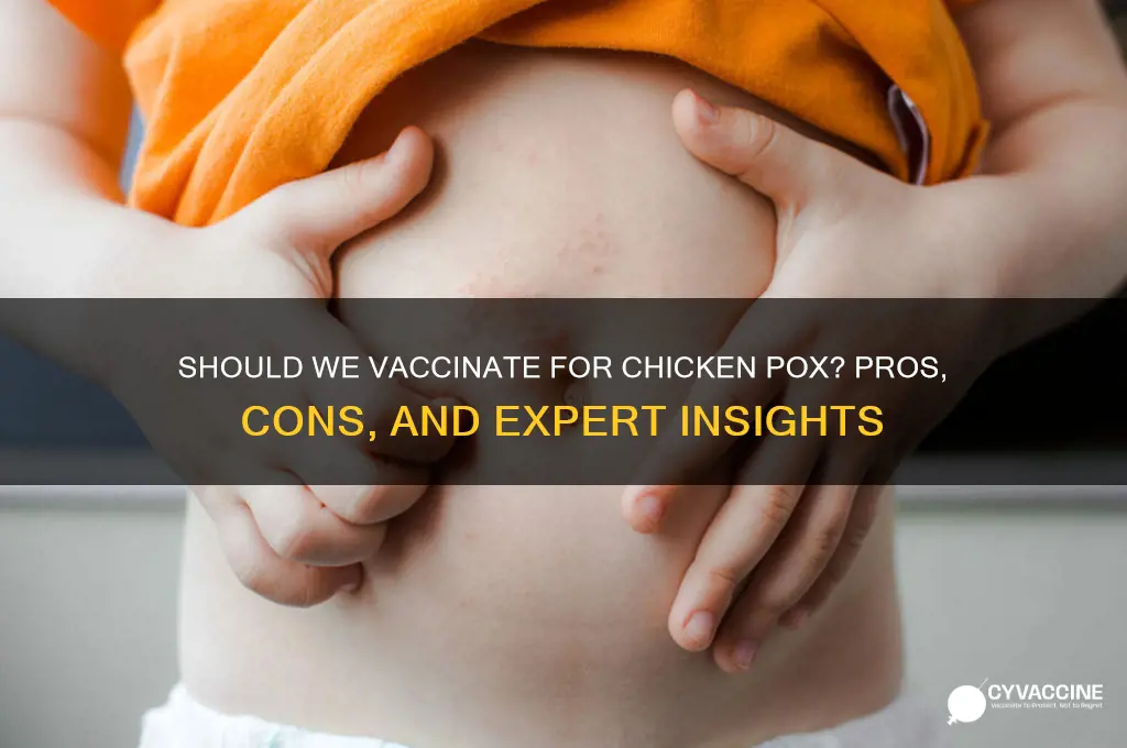 do we vaccinate for chicken pox
