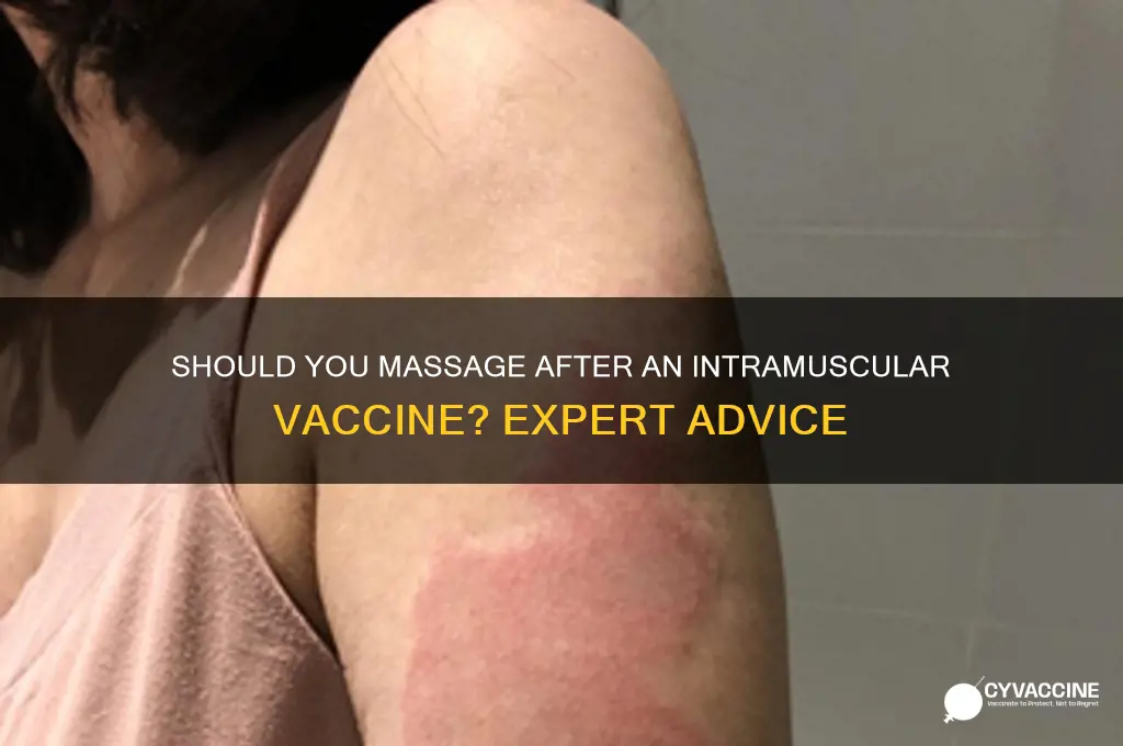 do you massage after intramuscular vaccine
