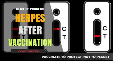Herpes Testing Post-Vaccination: What to Expect