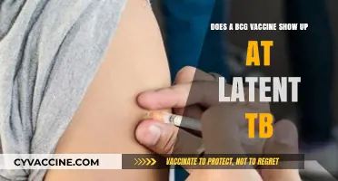 BCG Vaccines: Uncovering Latent TB