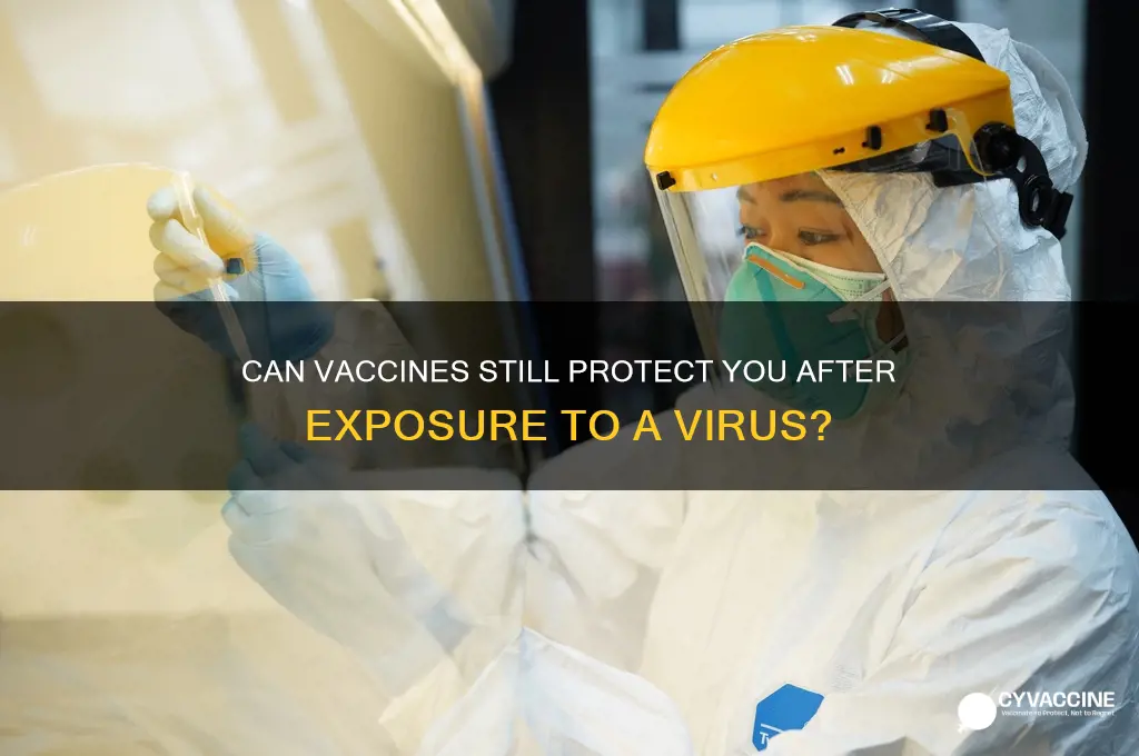 does a vaccine help after exposure