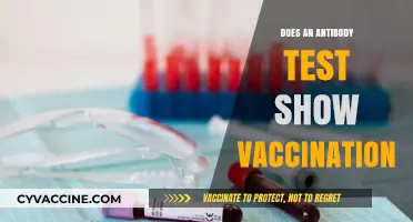Antibody Tests vs. Vaccination: Do They Show the Same Immunity?