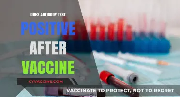 Does Antibody Test Show Positive After COVID-19 Vaccination?