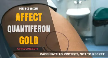 BCG Vaccine Impact on Quantiferon Gold Test Results Explained