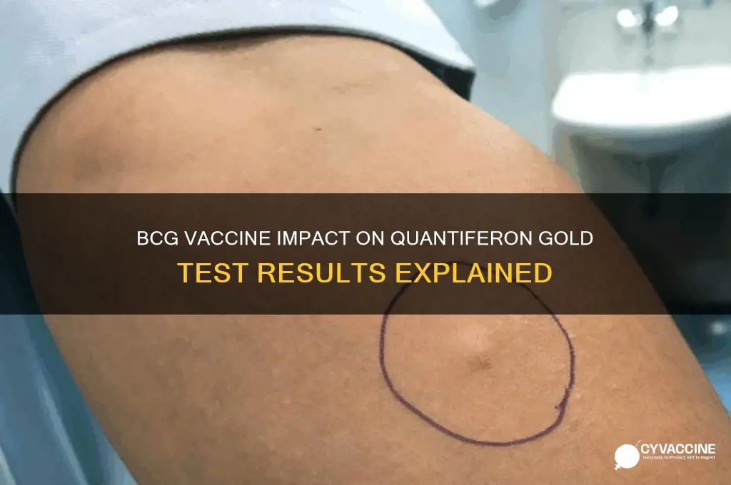 does bcg vaccine affect quantiferon gold