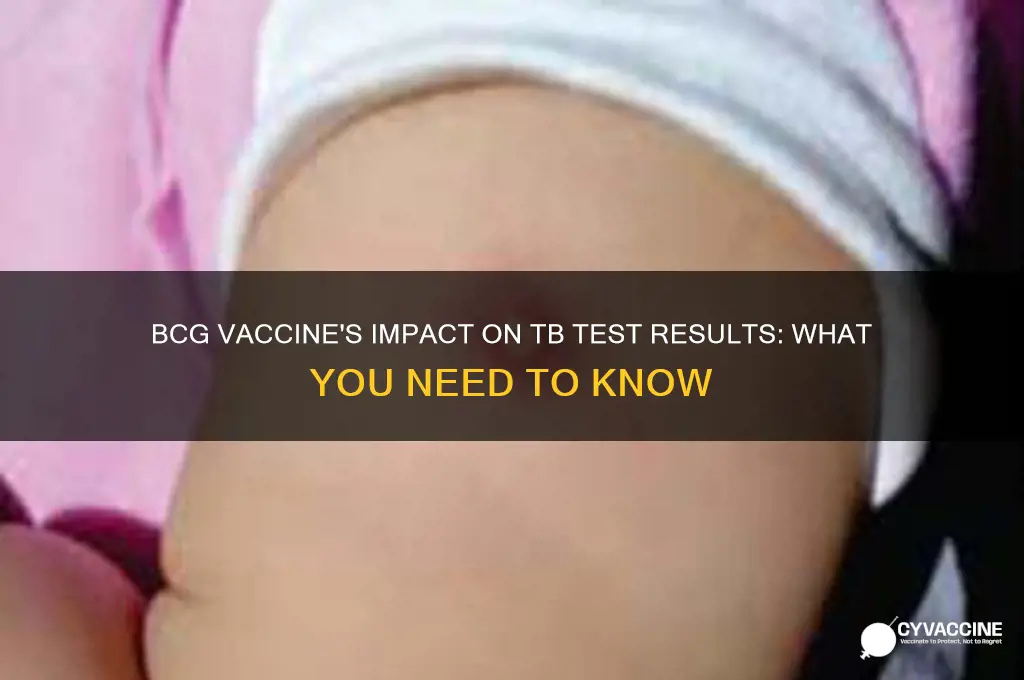 does bcg vaccine affect tb rest