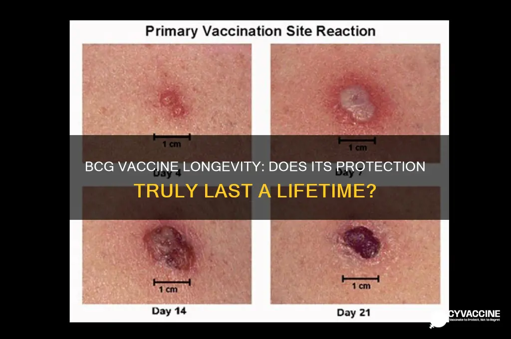 does bcg vaccine last a lifetime