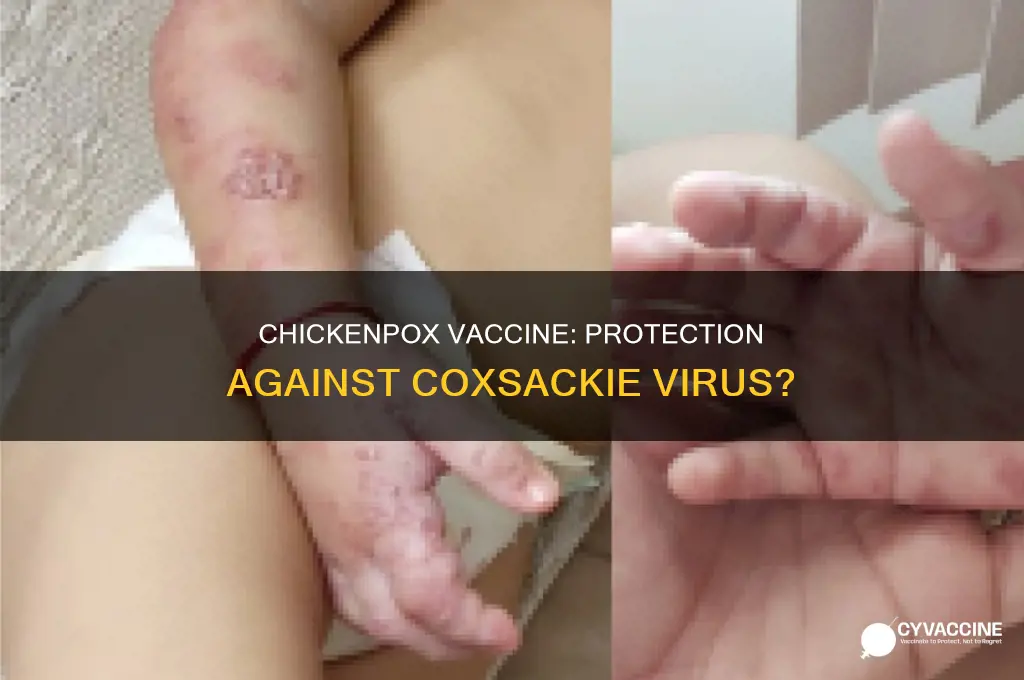 does chicke pox vaccine immunize against coxsackies virus aslos