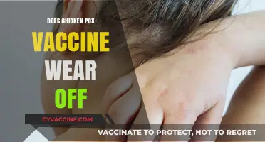 Does Chickenpox Vaccine Immunity Fade Over Time? What You Need to Know